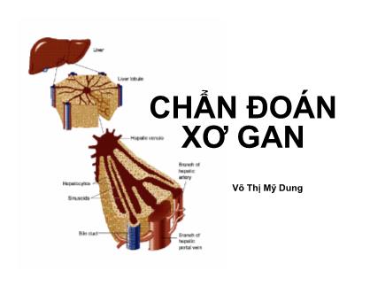 Bài giảng Chẩn đoán xơ gan - Võ Thị Mỹ Dung