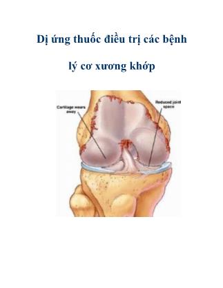 Bài giảng Dị ứng thuốc điều trị các bệnh lý cơ xương khớp