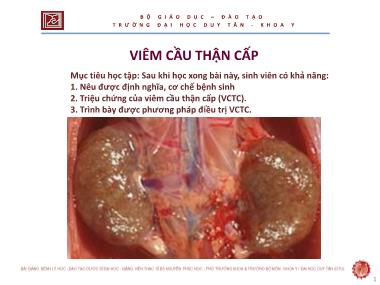 Bài giảng Viêm cầu thận cấp - ThS. Nguyễn Phúc Học