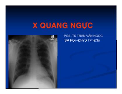 Bài giảng X quang ngực - PGS .TS Trần Văn Ngọc