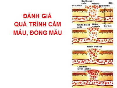 Đánh giá quá trình cầm máu, đông máu
