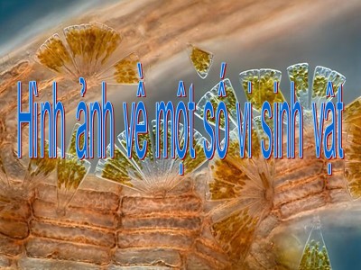 Hình ảnh về một số vi sinh vật - Mai Trường Nam